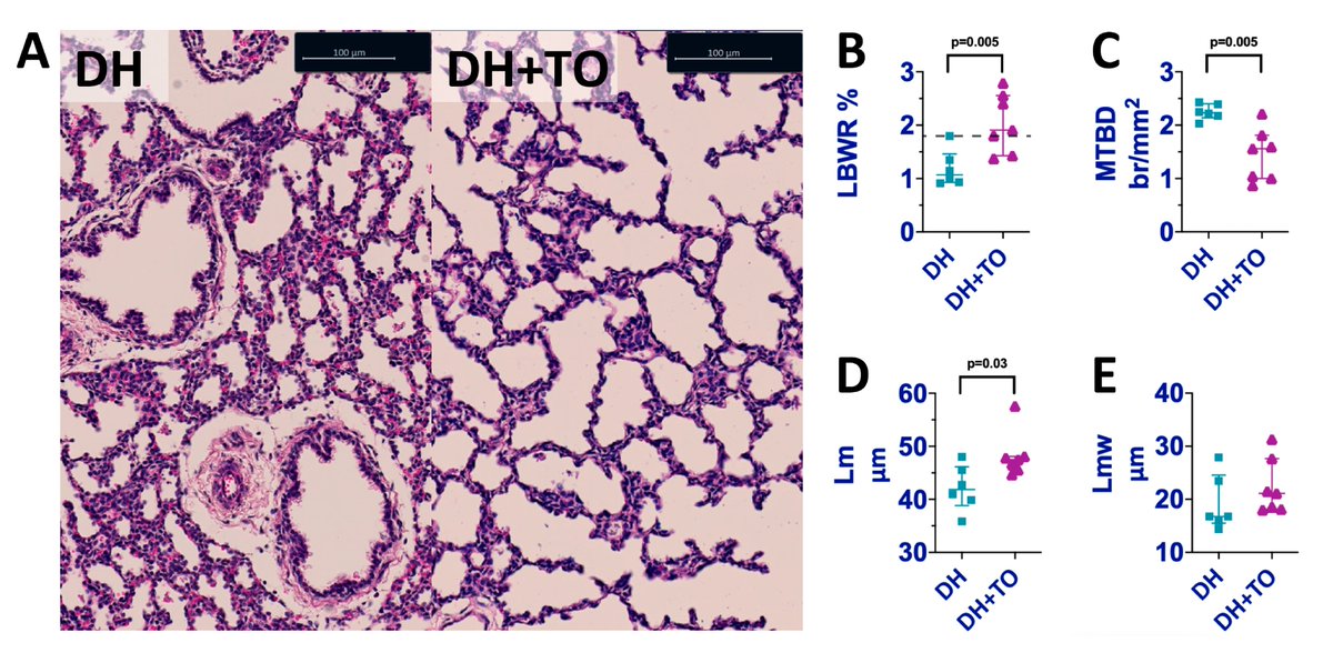 Tracheal occlusion using the Smart-TO balloon is effective and safe in fetal lambs with diaphragmatic hernia, finds new #UOGJournal study https://t.co/c1xPo96BOE https://t.co/v3bcpjjPEL