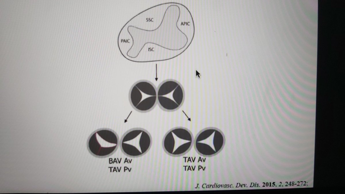 .<a href="/MonashHeart/">MonashHeart</a> using the power of Zoom for our Wednesday education. Spread across 3 campuses and some at home dialing in on a day off. #sonographer Bicuspid things bicuspid aortic valves. Thanks Dr Bon Chou #EchoFirst