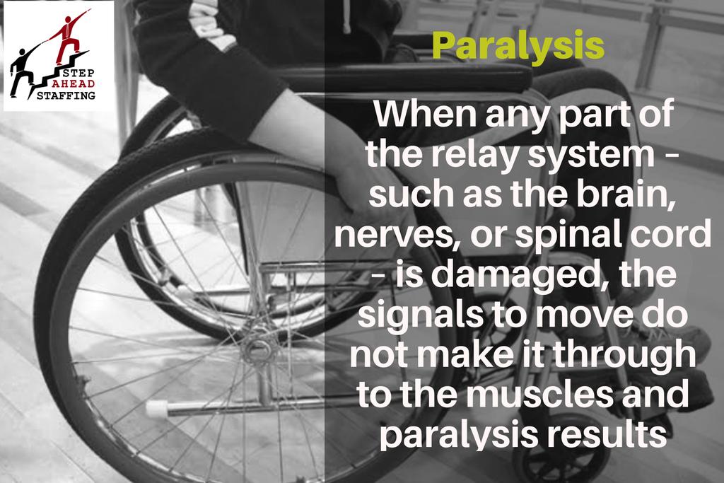 SAS_HRCS's tweet photo. Some people are born paralyzed. Others develop paralysis due to an accident or a med condition.

Localized paralysis affects only one part of your body such as your face or hand.
Generalized paralysis is a group of conditions that affect multiple body parts.
#paralysisAwareness https://t.co/ihoIiZIrA3
