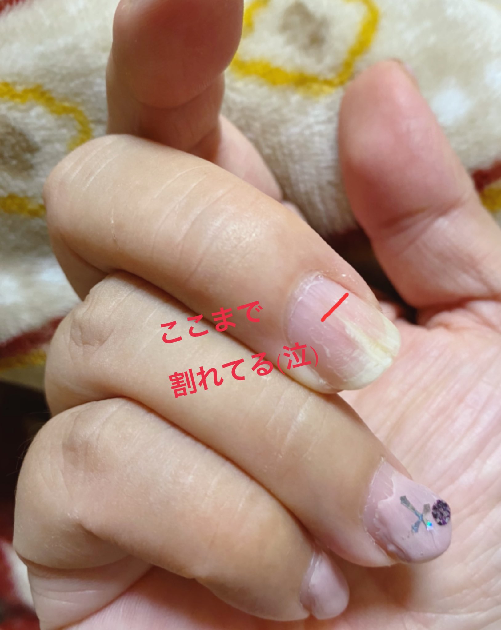割れ爪 Twitter Search Twitter