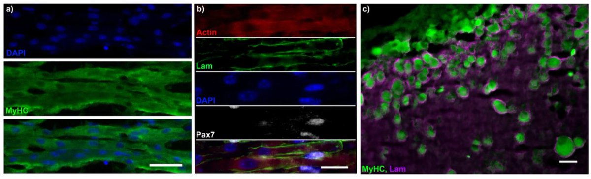 BMCBiology's tweet photo. New #openaccess research from @JW_Fleming and colleagues: Bioengineered human skeletal muscle capable of functional #regeneration

Read it here: https://t.co/oP6SlyU6QS https://t.co/ciBHm35ywY