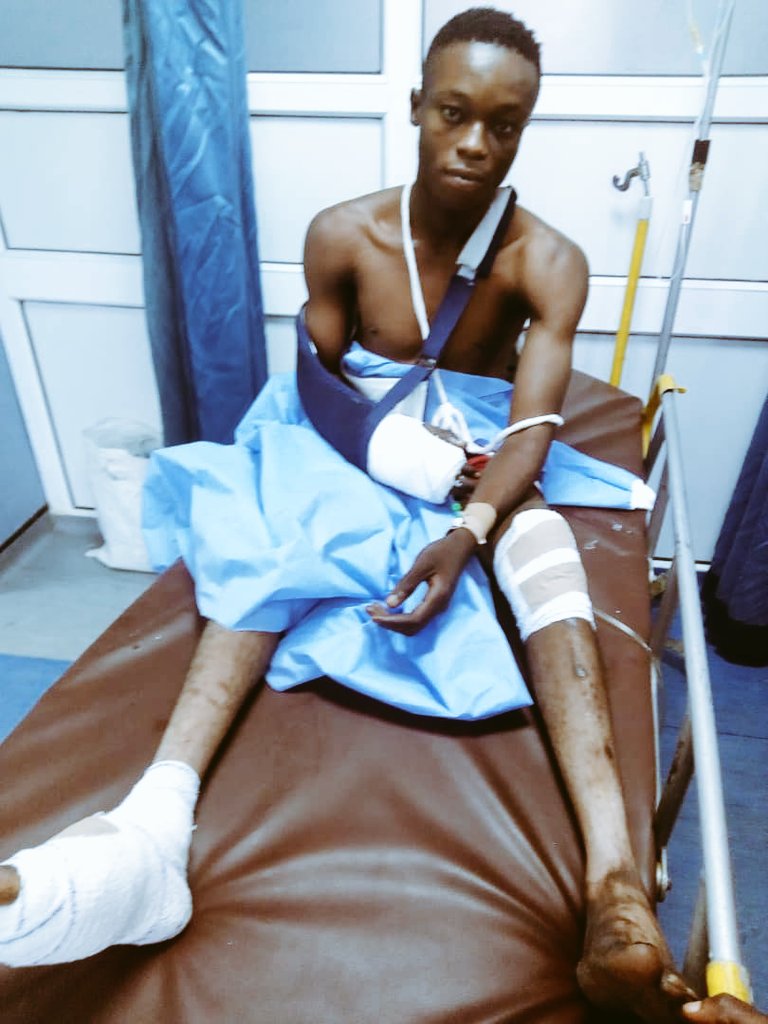 idyongclasik's tweet photo. MY LITTLE COUSIN WAS AMONG THE VICTIMS YESTERNITE...... HE LOST ALL HIS TEETH LEFT WITH JUST 4 AND THE BULLET ALMOST CUT OF HIS HAND BUT THANK GOD HE IS ALIVE.
and Lagos state Governor said no casualties Recorded 😭😭😭
God punish you SIR
help Retweet✊🏻
#EndBadGoveranceInNigeria https://t.co/Kj3lzQ1ADD