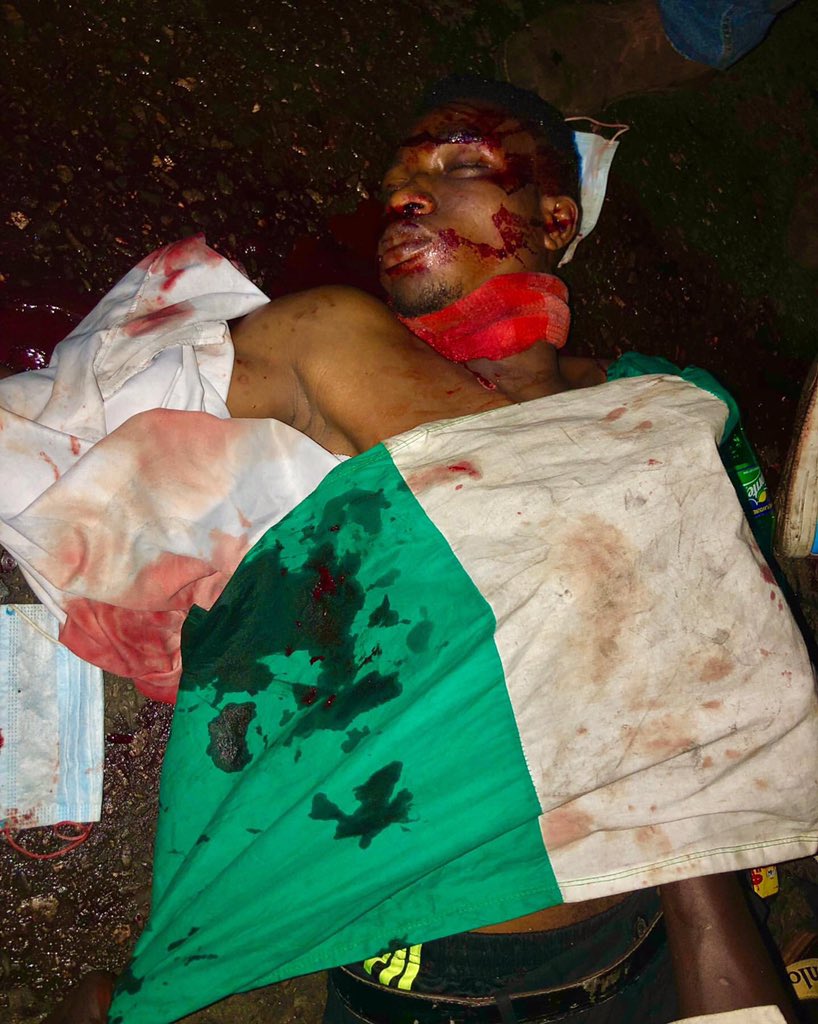 ike_exclusive's tweet photo. It may be a disturbing image but the world must see what the government is doing to its citizens. We won’t sit back and fold our arms. Stronger together. #Endsars #EndBadGoveranceInNigeria #LekkiMassacre #LekkiGenocide https://t.co/Ma5yv207gn