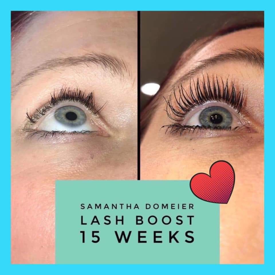 NotHannahsMom's tweet photo. I’d cry if this happened to me. 😭 Lash extensions are beautiful but they can destroy your natural lashes.

Lash Boost to the rescue! Lash Boost serum can boost even the saddest looking lashes. 

Message me to start protecting and growing your own eyelashes! https://t.co/KTojjUskmK