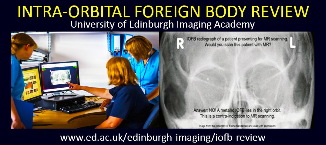 EdinUniNeuroImg's tweet photo. #Radiographers online CPD. Book on our next IOFB Review course: learn how to establish a programme & protocols for radiographer review of orbital radiographs for metallic IOFBs. Next session starts 30 Oct 20.
More info here: https://t.co/TrFnHeSyvD
#iofb #studyonline https://t.co/h0NY8BxSdj