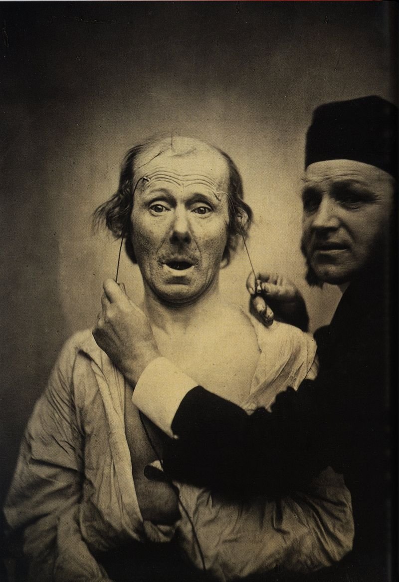 So his monograph Mécanisme de la physionomie humaine on the muscles of facial expression is full of scary pictures where he's zapping patients with electrodes and describing how it changes their expressions.