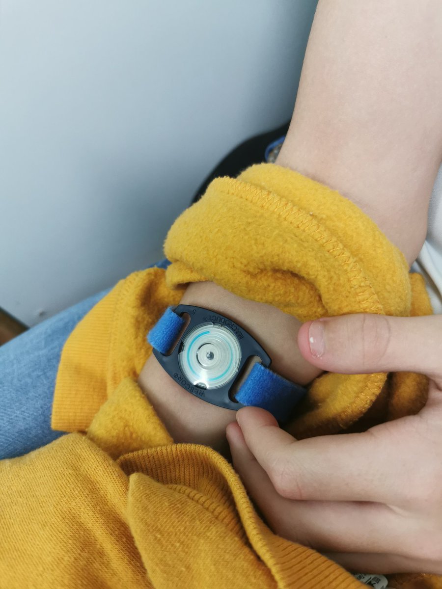 Sweat test ready for starting his new CF drug <a href="/cftrust/">Cystic Fibrosis Trust</a> <a href="/CFibrosisUK/">cystic fibrosis UK</a>