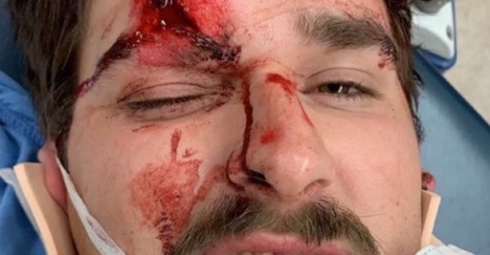 JenniferKellyTV's tweet photo. I’ve been Speaker @ #Drivefor45 pro-@realDonaldTrump events not too far from where this happened — If this can happen in red state Oklahoma, it will happen everywhere. Please consider giving to this couple’s Medical bills fund, they are severely injured: https://t.co/A5FJeXMGjc https://t.co/ngeCxUel56