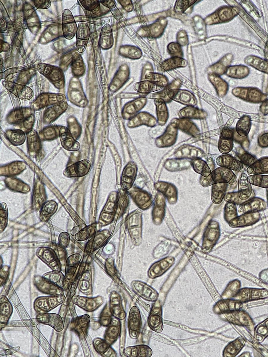 Patient with sinusitis, fungal culture growing this organism. What am I?