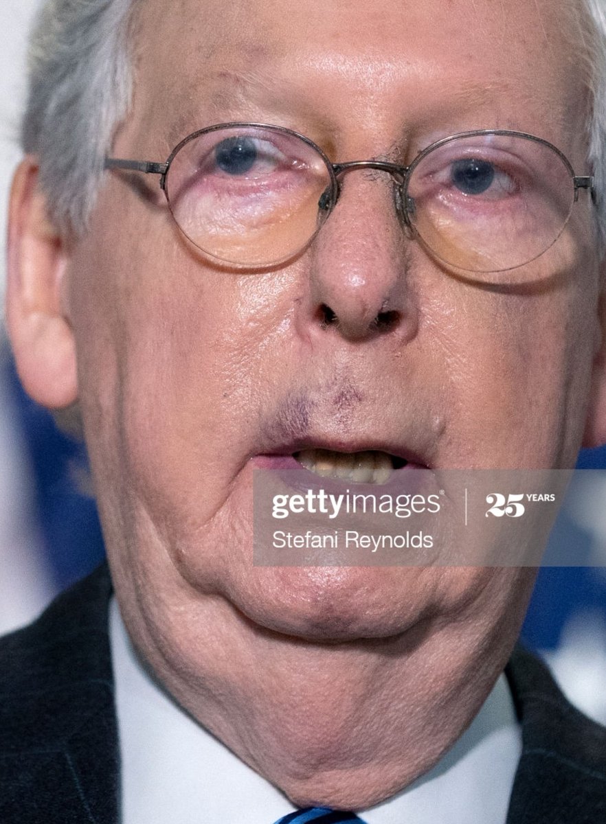 What is going on with Mitch McConnell's health?