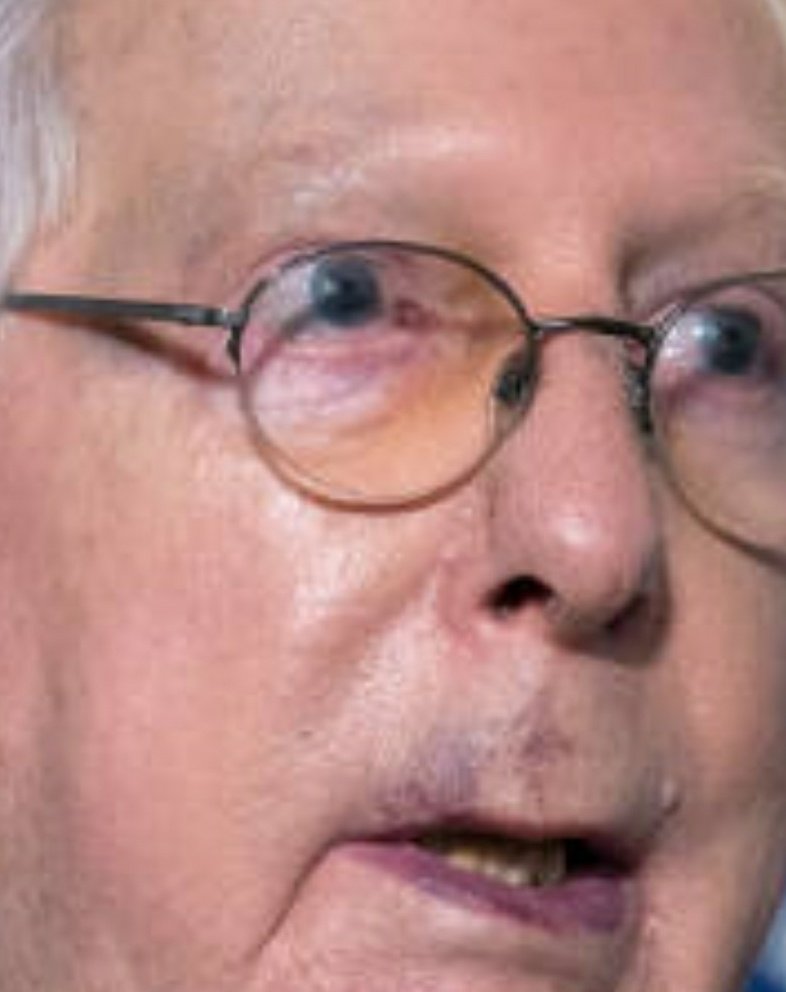 Either Mitch McConnell had a fist fight with someone or he is very sick. His face and both hands ... Looks like the press would ask questions and report  @courierjournal  @heraldleader