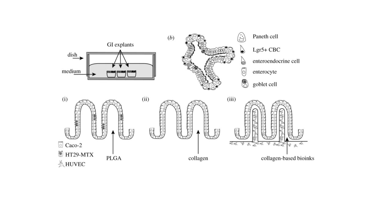Intestinal_Cell's tweet photo. Review | The authors of this review talk about #CellCultures, #IntestinalOrganoids, scaffold-based three-dimensional models, and organ-on-a-chip and their use in studying the interaction between human intestine and microbes 🦠. https://t.co/eVxOyEi4ON https://t.co/t8EVi3czuW