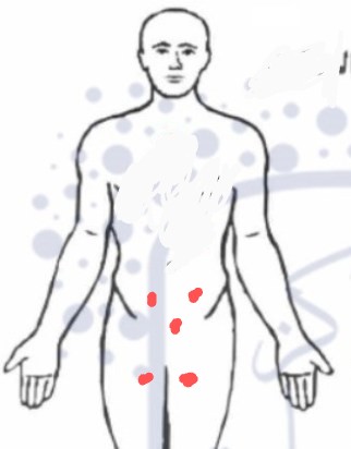 🔺 طرق استخدام الحجامة لعلاج السحر والمس والحسد..!

• قبل الحجامة
الصيام اقل شيء ٣ساعات
-نية المصاب ت...