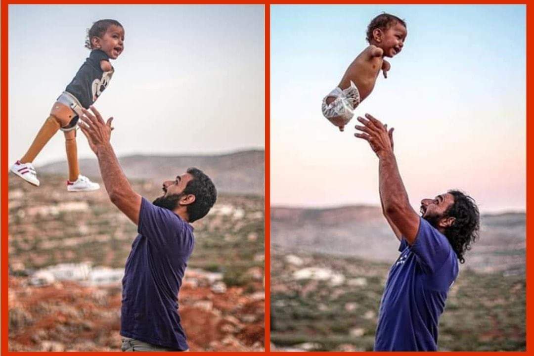 Mohammed Ghorab (@MGhorab3) on Twitter photo 2020-10-22 13:30:34 Before and after A child from #Idlib received treatment in #Turkey Before and after A child from #Idlib received treatment in #Turkey