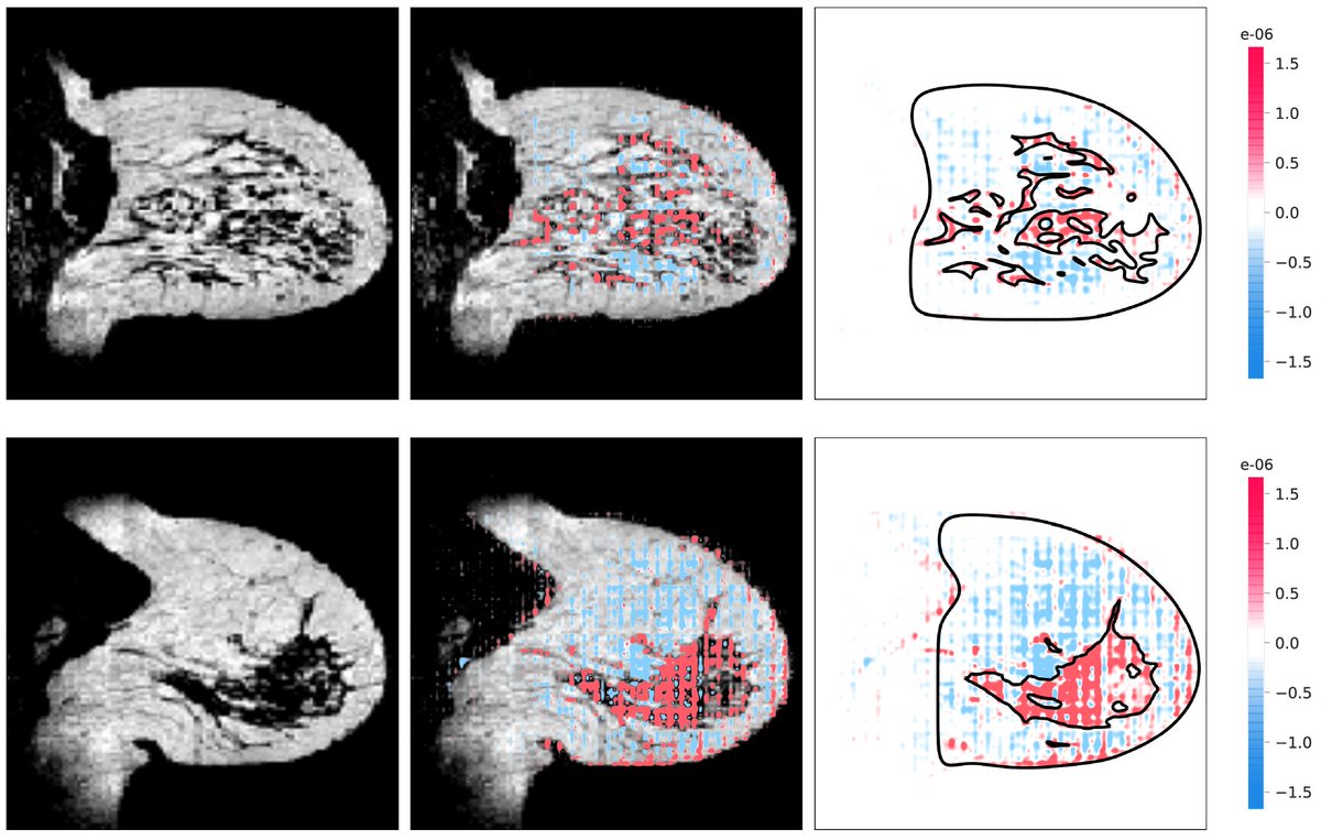 BasvanderVelden's tweet photo. In our new #AI paper, we estimate volumetric #breastdensity on #MRI using just one label per 3D image. We show radiologists why the AI gives a density percentage using eXplainable AI #XAI. 

https://t.co/N9Nttnn3W7

Funded by @kwf_nl 

@ISI_UMC @MHAJanse @SciReports https://t.co/Hu8MC3XVam