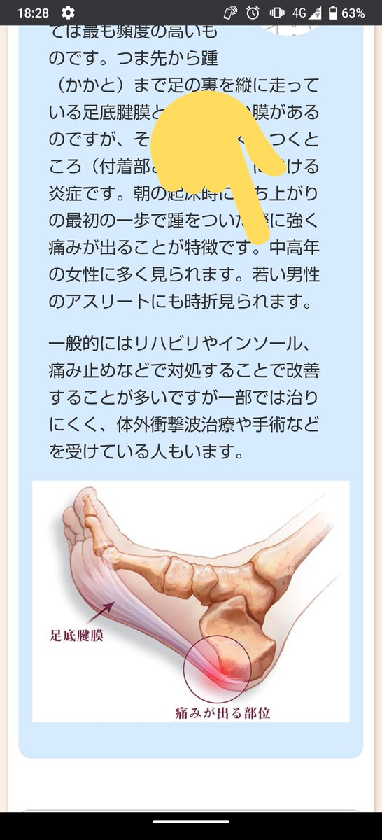 足底筋膜炎のtwitterイラスト検索結果
