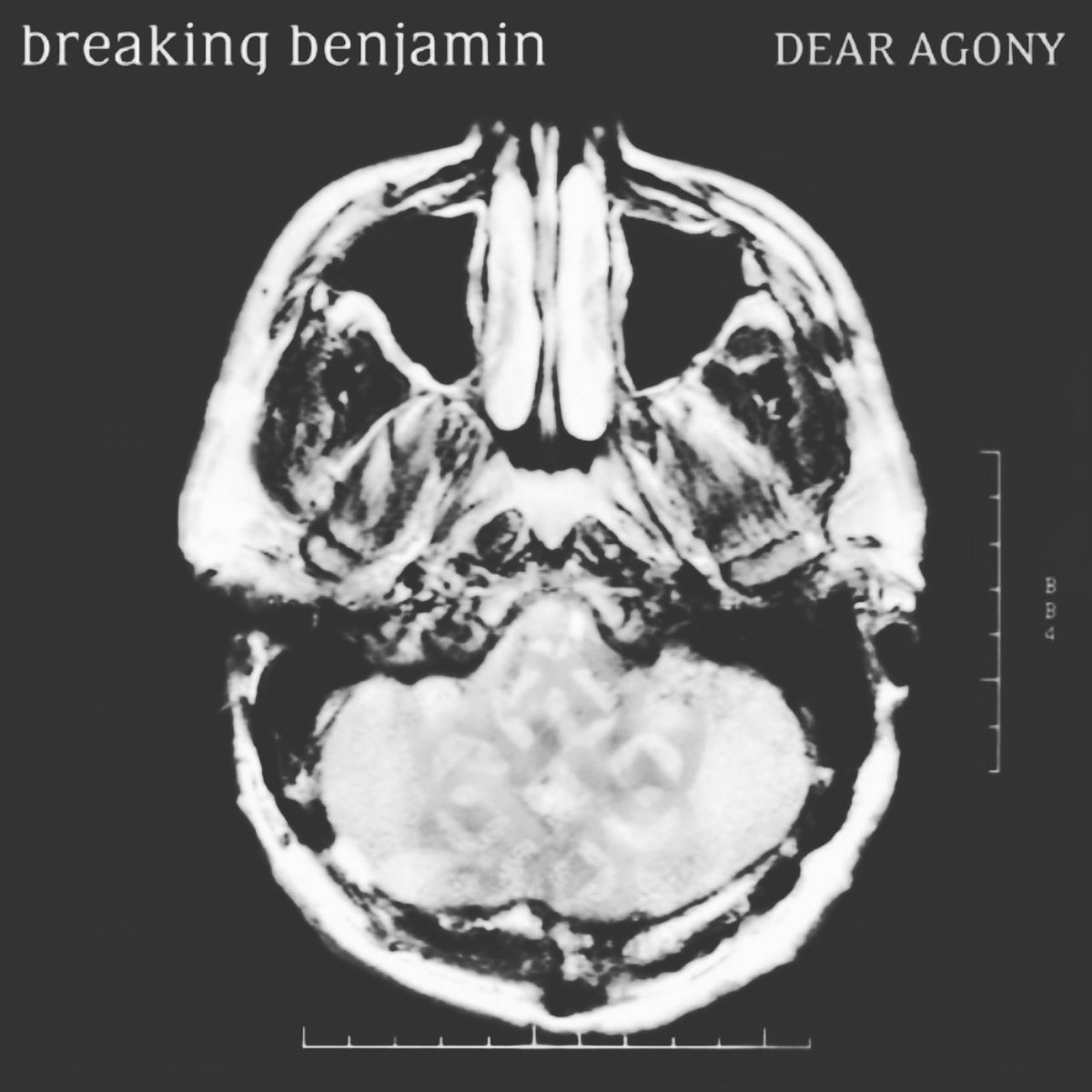 Breaking Benjamin
Dear Agony - 2009
Breaking Benjamin Dear Agony CD
Breaking Benjamin Dear Agony Download
Breaking Benjamin Dear Agony 320 kbps
#432Hz #432hertz
▬▬▬▬▬▬▬▬▬▬▬▬▬▬▬
https://t.co/49iZCTQwMs
▬▬▬▬▬▬▬▬▬▬▬▬▬▬▬ https://t.co/SgMuDCyIB8