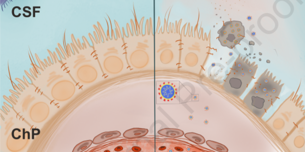 #SARSCoV2 does not significantly infect #neurons but productively infects the #brain choroid plexus in human brain #organoids, finds a team of @MRC_LMB researchers. Read more from the study in <a href="/CellStemCell/">Cell Stem Cell</a> hubs.ly/H0y8Gk80