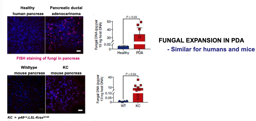 3a) 10.1038/s41586-019-1608-2 – Fungal mycobiome -> panc oncogenesis via mann binding lectin; Mycobiota expansion a/w panc ductal adeno CA; Despite expansion in burden, decreased diversity w/ inc Malassezia (20% pop.); AmB admin led to several anti-onc changes (pic 2).