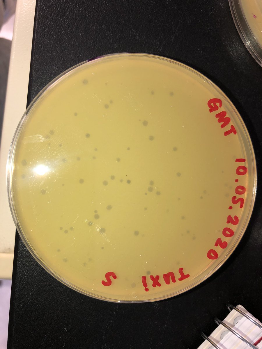 PPhinders's tweet photo. This week the phage lab at UCONN worked on phage amplification! We are attempting to create webbed plates so we can collect enough phage to run tests 🤓 My phage has lost infectivity over time, so this is the closest I have gotten to a webbed plate! Wish me luck next week! -Gabby https://t.co/CFl3SCN7g6