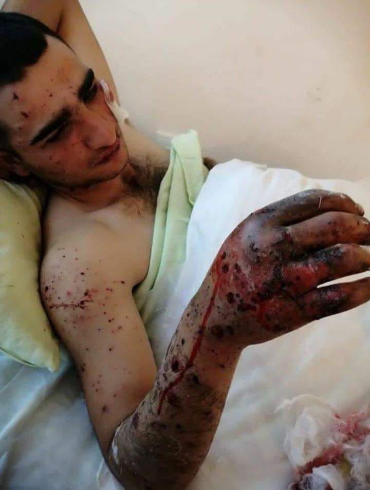 #GenevaConvention are you there??? Stop closing your eyes and ears!!!!
"Just now, another rocket was launched from the territory of Armenia to the Azerbaijani city of #GANJA !!!"
Where and how shout, to be heard? Someone has to stop this terrorism. #StopArmenianTerrorism