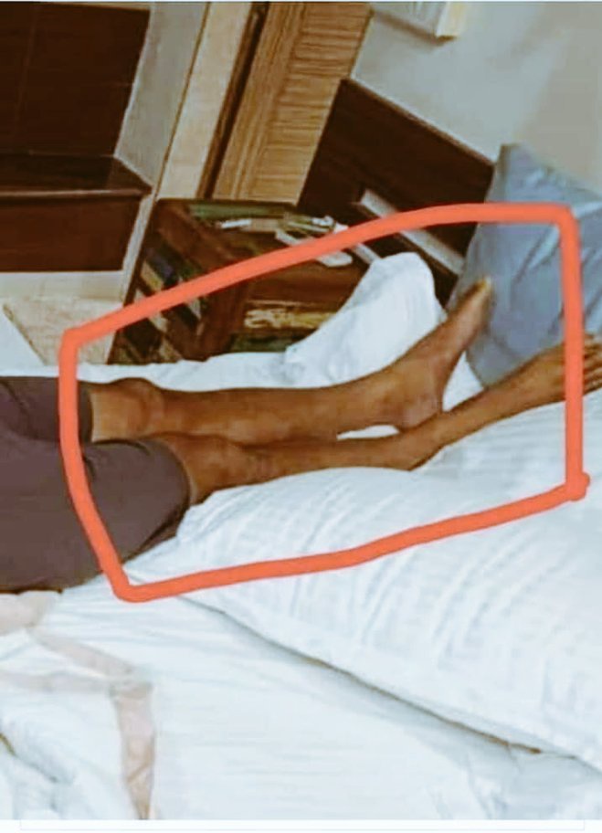 ShirityS's tweet image. Enough is enough I request to @Swamy39 @PMOIndia @cbic_india please make Other team.#sudhirguptasoldout he can&apos;t See that How #SSR leg is broken deeply by hardobject.All World-wide expert ForensicDrs R saying it&apos;s burtal Murdure😔 🔱#CBIStartArrestInSSRCase @vikashranjan @itsSSR