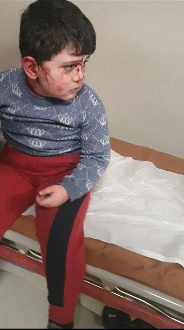 I am a boy from #Ganja. 
#Armenia shooting us. 
We never give up
<a href="/UNICEF/">UNICEF</a> <a href="/antonioguterres/">António Guterres</a> <a href="/UN/">United Nations</a>  <a href="/UNHumanRights/">UN Human Rights</a> <a href="/UNFPA/">UNFPA</a> <a href="/UNESCO/">UNESCO 🏛️ #Education #Sciences #Culture 🇺🇳</a>