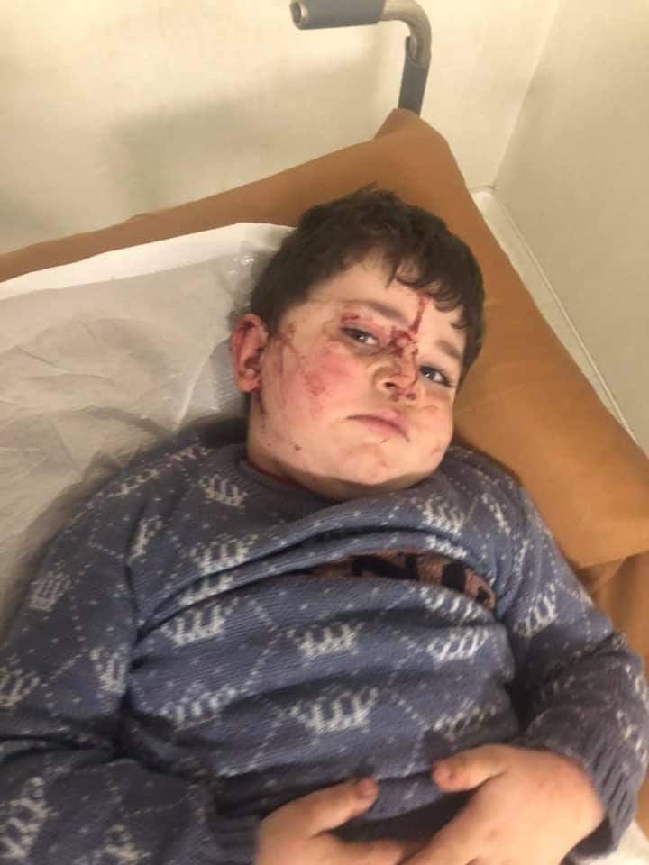iamasapgold's tweet photo. Kardashian family backs terrorism. They give millions of dollar armenia armed forces. After that in the midst of night Ganja city came under missile attack of Armenia. 10 civilians killed 33 civilians including kids seriously wounded.

#KardashiansSupportTerrorism
#PrayForGanja https://t.co/muoZGBA5a0
