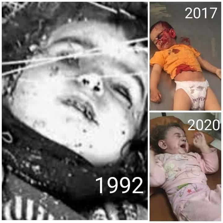AzadKhanAlizade's tweet photo. 🇪🇸 #DíaDeLaNiña:Mira las imágenes que compartimos bajo este #hashtag. Aquí vemos 3 chicas hermosas: 1 en #Khojaly (1992) 1 en #Fuzuli (2017) y 1 en #Ganja Las 2 primeras fueron asesinadas; la 3a está herida como resultado de un bombardeo de artillería por los armenios @UNICEF @UN https://t.co/Nqv668yFtp