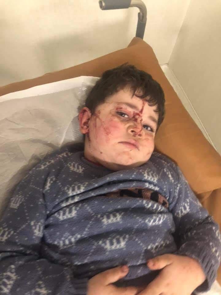 The #shelling of #civilians in #Ganja city by the #Armenia's armed forces after the humanitarian ceasefire agreement is another clear example of #barbarism and shows that the ceasefire calls of the Armenian leadership are nothing but #hypocrisy.