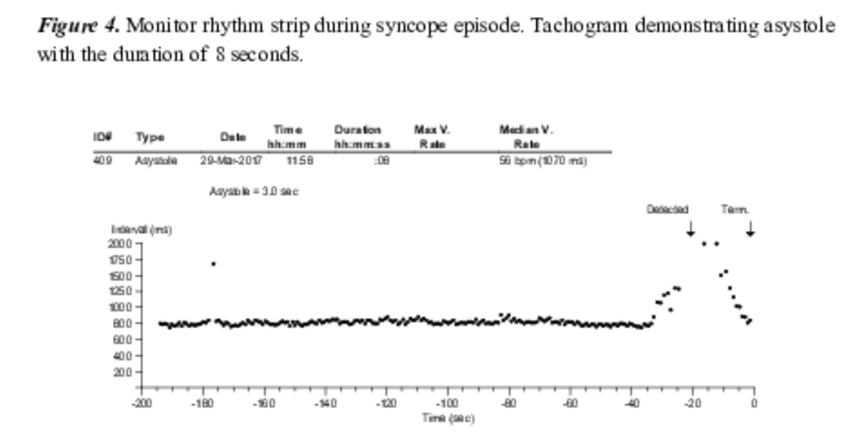 gbiondizoccai's tweet photo. Diagnostic yield of implantable loop recorders in patients with unexplained syncope: single-centre experience, by Kajdič et al
https://t.co/EaxAiSw6vG
#MinervaCardioangiologica
#syncope #looprecorder #diagnosisdetectives https://t.co/MtsE4Qn9wA