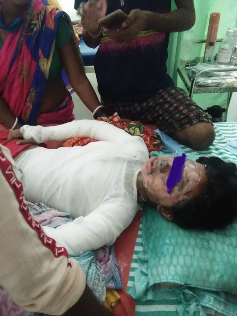 Burn victim succumbs. Case fm Katihar district, Bihar. details cn b provided. The girl in a video before her death claims she was burnt by her husband &amp; his mother. Request immediate help fm Katihar authorities. E-mail has already been sent with details to <a href="/NCWIndia/">NCW</a> <a href="/sharmarekha/">Rekha Sharma</a>