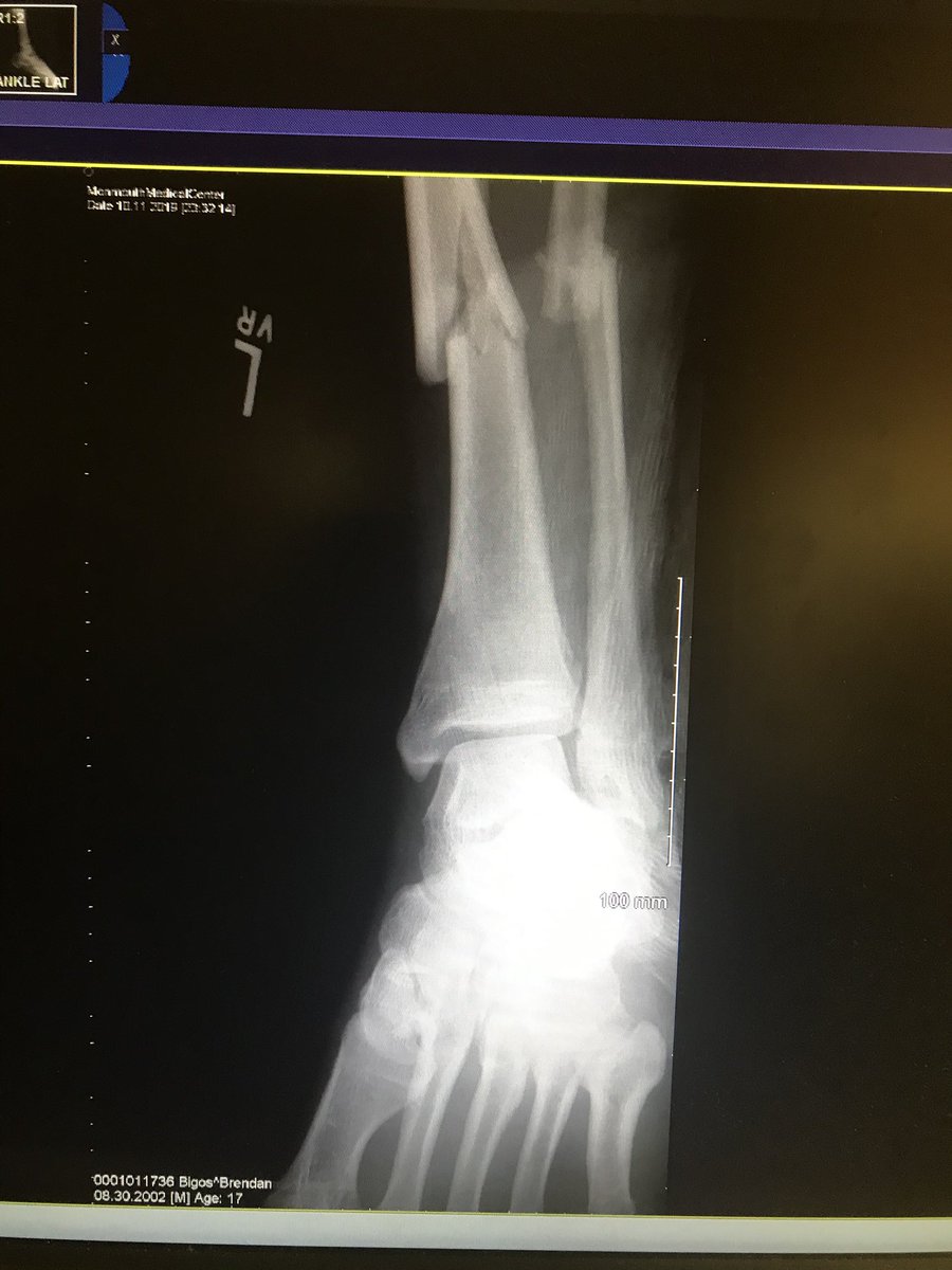 Brendan Bigos tweet media