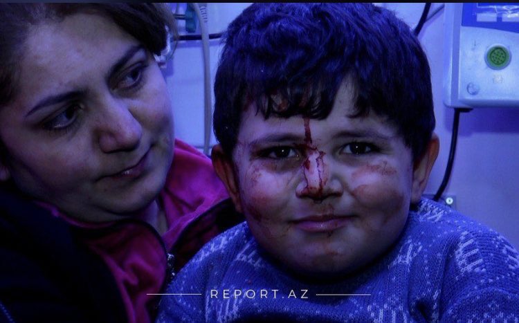 aliyevaaa_'s tweet photo. The ancient city of Ganja was terrorized by the Armenian Armed Forces. Armenia and its supporters do not shy away from pursuing an aggressive policy and choose the civilian population as their main target.!
#DontBelieveArmenia #PrayForGanja #Ganja #StopArmenianAggression 
@UN https://t.co/S3BhgTUTQH