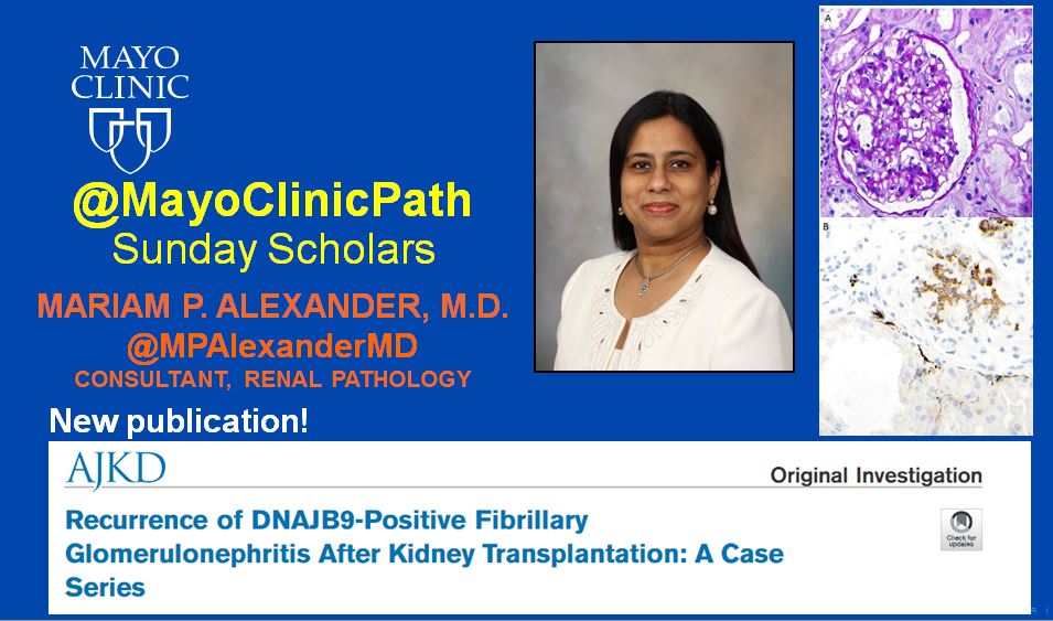 MayoClinicPath's tweet photo. Exciting and important new publication by our very own @MPAlexanderMD in @AJKDonline ! Read it here: https://t.co/LrSSL5aGmw https://t.co/v8avbk8SFp