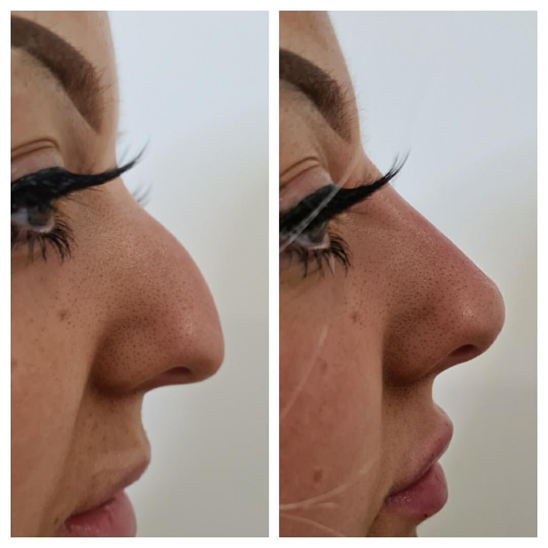 Ashleigh tweet media