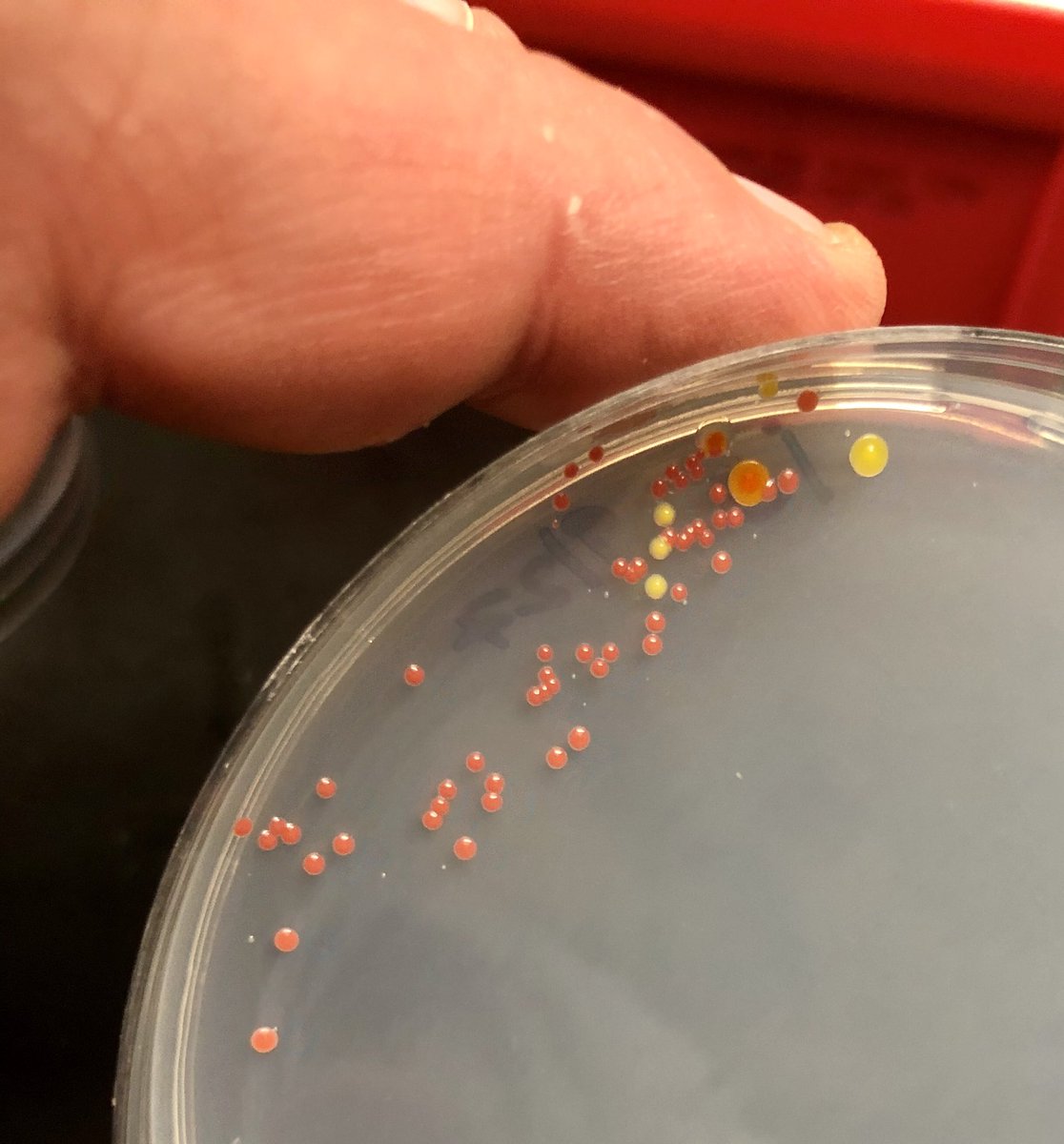 markowenmartin's tweet photo. Swab from the water bottle refill station on my floor on R2A media. I am going to 16S them for my #Bio350 #Micronauts. Anyone want to guess the identity of the pink and yellow colonies ahead of time? #WaterBottleBuddies. @univpugetsound @ASMicrobiology https://t.co/5HvL86UZDh
