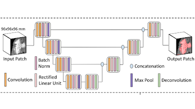 Radiology_AI's tweet image. A Bayesian network used 11 imaging features + 4 clinical features to compute probabilities of 35 common &amp;amp; rare diseases of deep gray matter doi.org/10.1148/ryai.2… @asset25 @MichaelDuongMD @PennRadiology #BayesNets #BayesianNetworks #AI