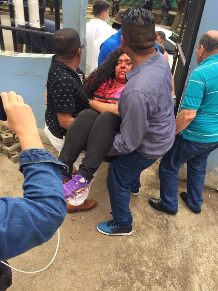 IrisKCT's tweet photo. Violencia criminal este fin de semana contra opositores en Nicaragua. https://t.co/EzHksgq4LP