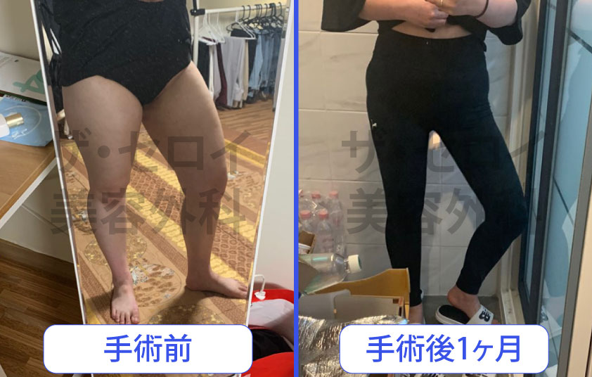ザ セロイ美容外科 Theseroijp Twitter