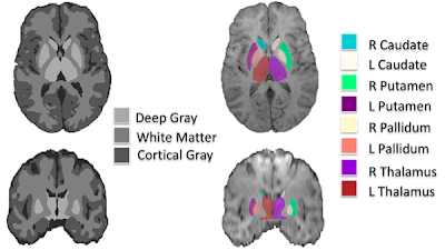 Radiology_AI's tweet image. Integrating #DeepLearning and #BayesianNetworks for expert-level brain MRI diagnosis doi.org/10.1148/ryai.2… @RadRudie @asset25 @UCSFimaging #BayesNets #AI #MachineLearning