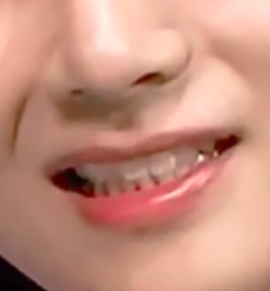 vantecentric's tweet photo. teefs :( https://t.co/kn3boSM4jm