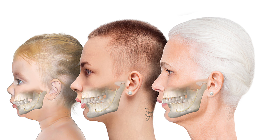 quintpub's tweet image. Proportionally, the small mandible is eternal, and surgical intervention is the solution. Learn how to manage the small jaw at these various stages of life to make sure your patients can breathe normally, eat normally, and function normally. Coming in 2021! #6Ways