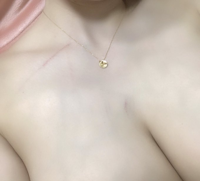 ちょっと出かけて帰ってきたらチャチャの激しいハグで、愛の傷ができました💜 寂しかったよねごめんね😭🥺 https://t.co/ZNkOxbS9Z4<a href="/tag/bdanri"class="tags"><span>#bdanri</span></a><a href="/tag/0517blackdiamond"class="tags"><span>#0517blackdiamond</span></a>