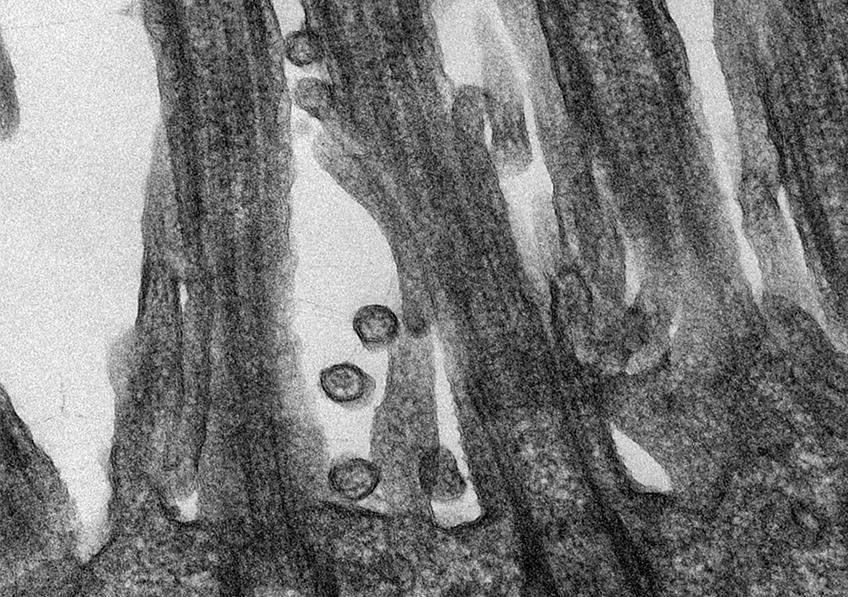 Que sait-on sur les mutations du coronavirus à l’origine de la Covid-19 ? Et que peuvent-elles nous apprendre sur l’évolution possible de la pandémie ? Le nouveau Canal Détox <a href="/Inserm/">Inserm</a> se penche sur ces questions ⬇️

bit.ly/3iRFkGX