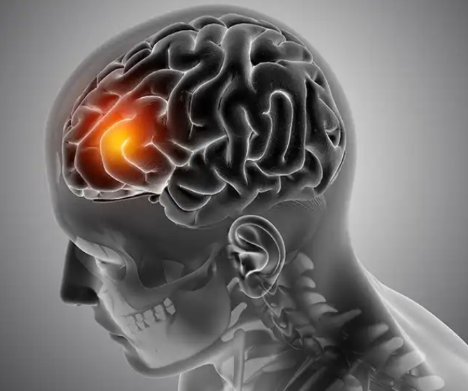 pewa_ke's tweet photo. Brain tumor is a disease that silently kills humans today within a short time, If a meningioma grows or causes swelling that presses against the brain or other structures in the skull, it can cause brain tumor, truly you can be with someone who https://t.co/rshTBbG8N4 https://t.co/VpVVejp2nl