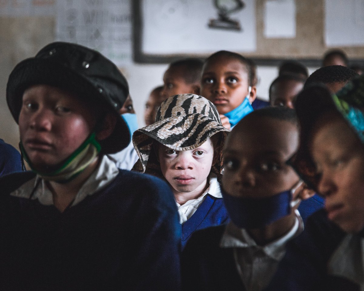 LethalCrysis's tweet photo. Albinos en África, en grave peligro. Perseguidos y asesinados. Un reportaje que necesita de mucho apoyo, luchemos por el cambio. 

https://t.co/YtzRHGtaVQ https://t.co/vyapwH2qle
