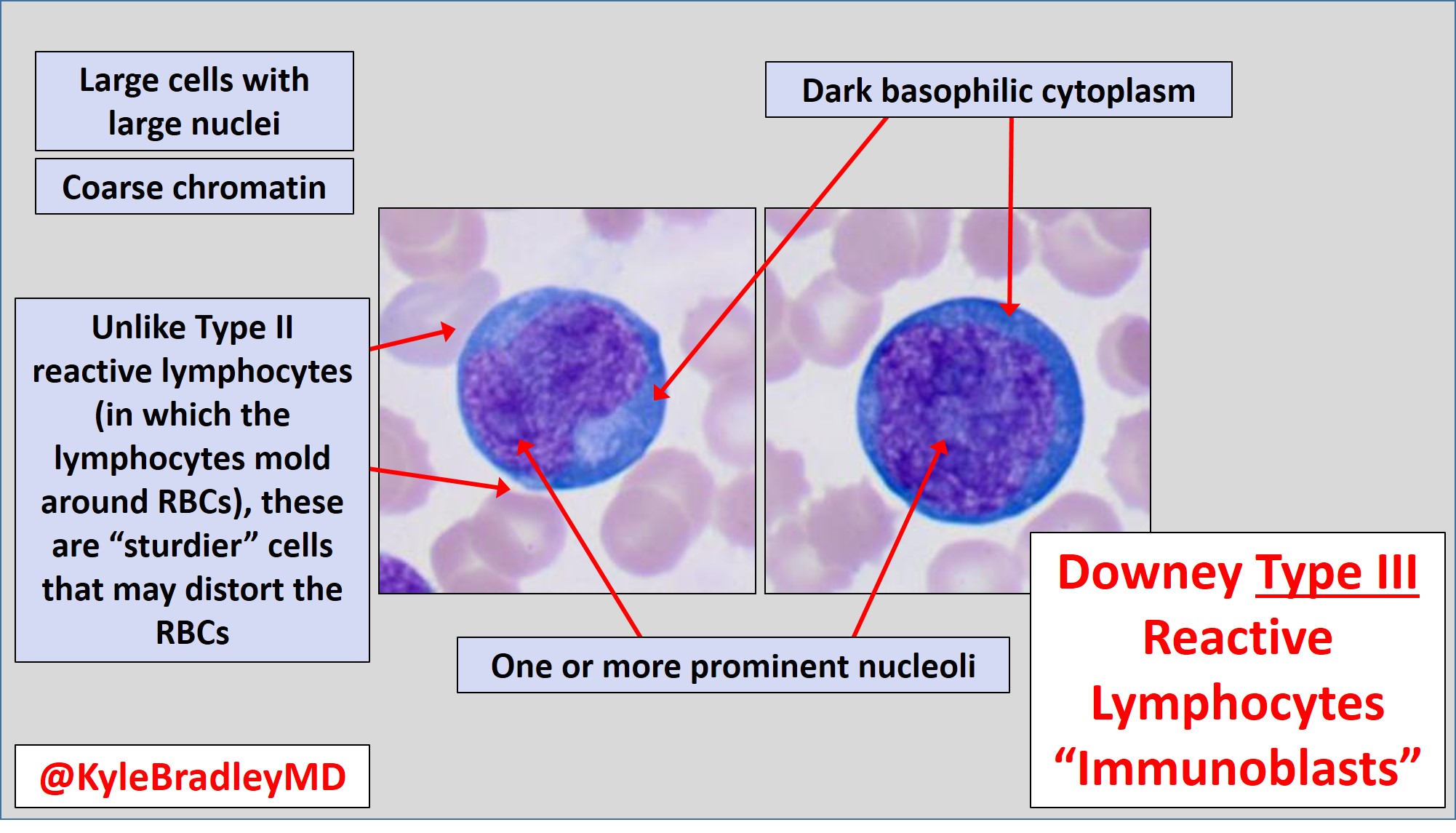 Lymphocytes Types