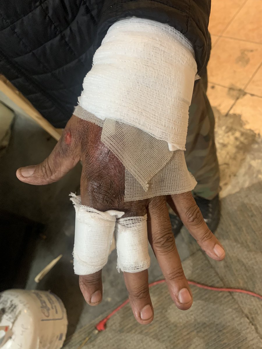 GuruVirk10's tweet photo. Worst bandage done and on my brother burnt hand at Brampton LHIN clinic @BmptGuardian @TC_LHIN @Central_LHIN @brampton_news . Staff is so #rude #unprofessional un ethical . Big ripoff and Fraud with Ontario tax payers. #OHIP should not pay this unprofessional services. https://t.co/ak1tuDEHcB