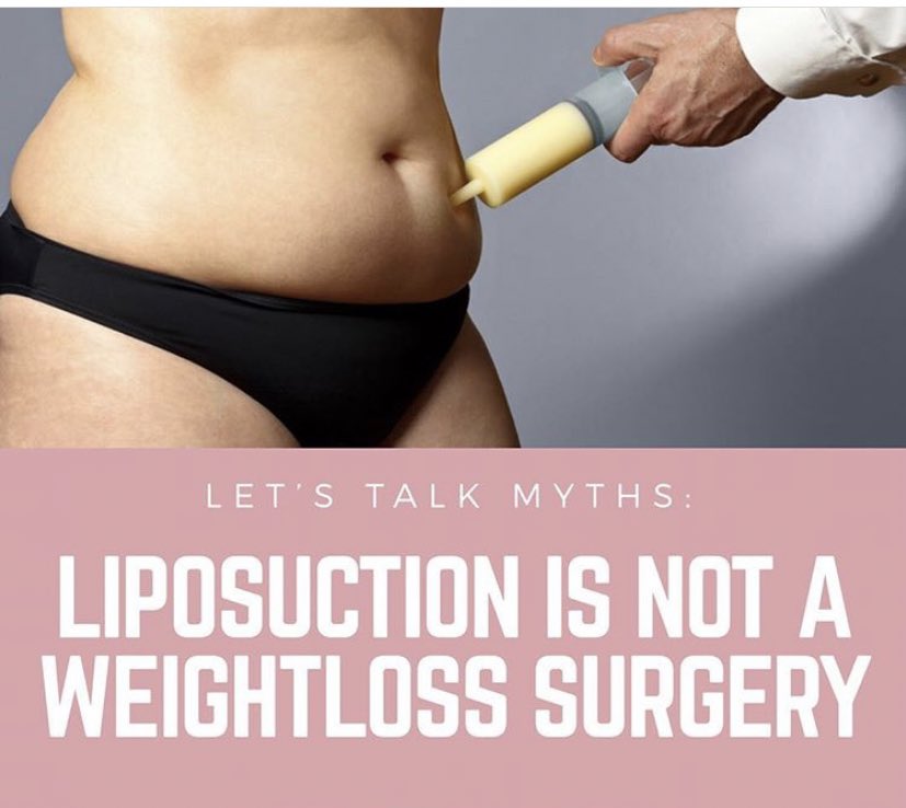 Liposuction is a BODY CONTOURING procedure. IT IS NOT A WEIGHTLOSS procedure. If you're overweight, you're likely to lose more weight through diet and exercise or through bariatric procedures — such as gastric bypass surgery — than you would with liposuction.